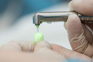 Laser Dentistry Manassas, VA